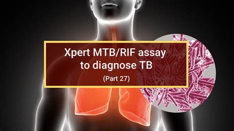 mtb not detected|A New Tool to Diagnose Tuberculosis:The Xpert MTB/RIF Assay.